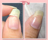 NailRepair™ - Sofortiges Nagelschutzgel