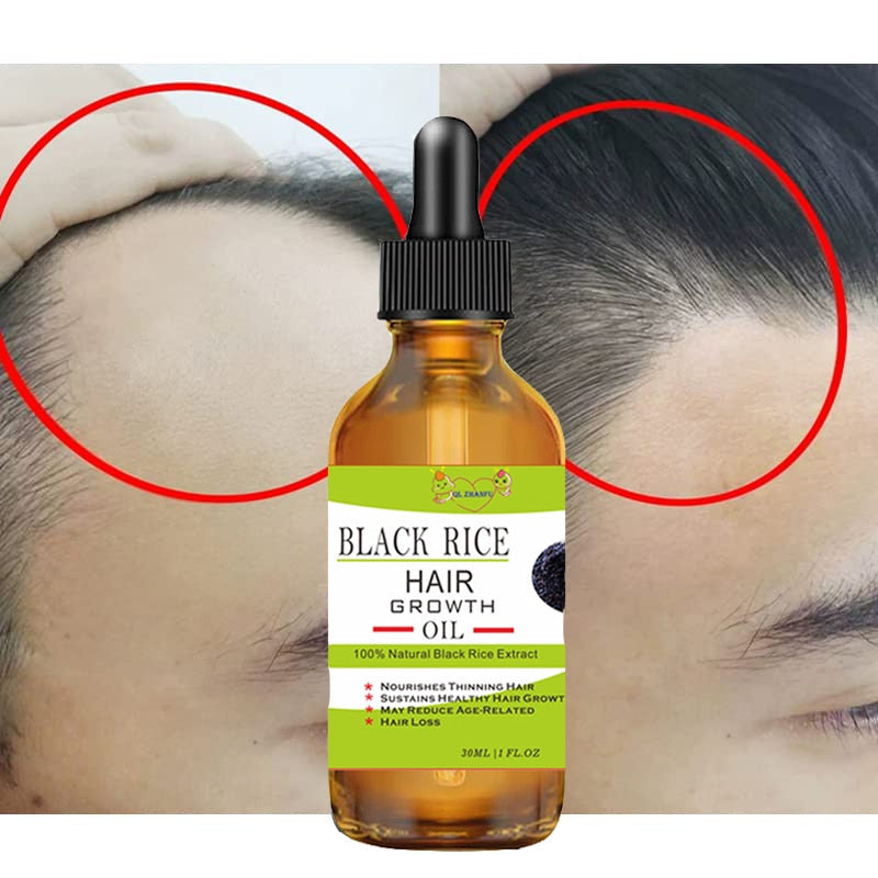 BlackRice™ HAIRGROWTH  HAAR ÖL 1+1 GRATIS